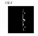Fig. 07 - Tire defect detection method