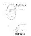 Fig. 04 - FINGER GUIDE DEVICE WITH CIRCUMSCRIBING RING