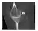 Fig. 01 - Multi-bone segmentation for 3D computed tomography