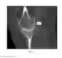 Fig. 02 - Multi-bone segmentation for 3D computed tomography