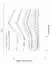 Fig. 07 - Reduced-diameter optical fiber