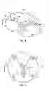 Fig. 02 - Quick disconnect securement device