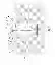 Fig. 02 - Device and method for introducing a filling material