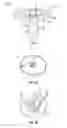 Fig. 03 - Weight screw