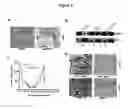 Fig. 04 - Methods for treating castration resistant prostate cancer and metastasis by reducing B-cell number and/or function