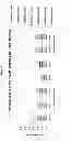 Fig. 06 - TUBERCULOSIS RV2386C PROTEIN, COMPOSITIONS AND USES THEREOF