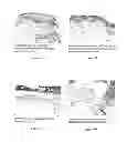 Fig. 30 - METHODS OF WOUND CARE AND TREATMENT