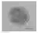 Fig. 01 - Ultraviolet-shielding agent, method for producing the same, ultraviolet-shielding agent-containing dispersion liquid, and cosmetic preparation