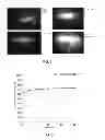 Fig. 06 - Biodegradable drug delivery systems for the sustained release of proteins