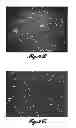 Fig. 07 - POLYMER MICROSPHERE COMPOSITIONS FOR LOCALIZED DELIVERY OF THERAPEUTIC AGENTS