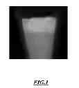 Fig. 02 - Gallium-doped phosphocalcic compounds