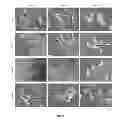 Fig. 17 - Modulators of HSP70/DnaK function and methods of use thereof