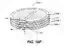 Fig. 25 - LEAD-ACID BATTERY DESIGN HAVING VERSATILE FORM FACTOR