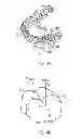 Fig. 04 - System and method for digital tooth imaging