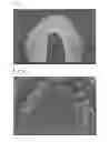 Fig. 02 - MULTILAYER MOUTHPIECE, MANUFACTURING METHOD AND MANUFACTURING DEVICE THEREOF