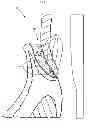 Fig. 08 - PERIODONTAL TREATMENT SYSTEM AND METHOD