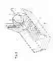 Fig. 07 - Device for spatially moving persons