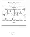 Fig. 05 - Exercise training system