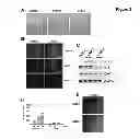 Fig. 04 - Methods for the Treatment, the Prognostic Assessment and the Staging of Non-Small Cell Lung Cancer