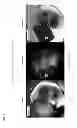 Fig. 06 - METHOD FOR MAKING BIOLOGICAL MATERIAL TRANSPARENT AND USE THEREOF