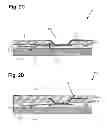Fig. 04 - Fabricating a wafer level semiconductor package having a pre-formed dielectric layer