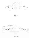 Fig. 03 - Method for measuring material removal during surface finishing on curved surfaces