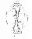 Fig. 02 - Chain tensioner lever