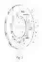 Fig. 03 - OIL TRAP RING DISK FOR A PLANET WHEEL CARRIER