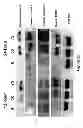 Fig. 17 - Compositions and methods for localized drug delivery through mammary papillae