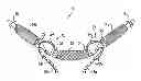 Fig. 01 - Implants, tools, and methods for treatment of pelvic conditions