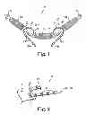 Fig. 02 - Implants, tools, and methods for treatment of pelvic conditions