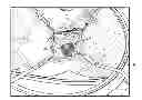 Fig. 01 - Rectal Prolapse Treatment Methods, Devices, and Systems