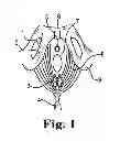 Fig. 02 - Rectal Prolapse Treatment Methods, Devices, and Systems