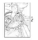 Fig. 07 - Rectal Prolapse Treatment Methods, Devices, and Systems