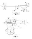Fig. 06 - Tools and methods for treatment of pelvic conditions
