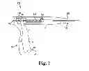 Fig. 07 - Tools and methods for treatment of pelvic conditions