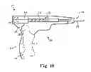Fig. 09 - Tools and methods for treatment of pelvic conditions