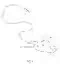 Fig. 02 - Nasogastric Scope