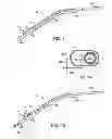 Fig. 02 - Illuminated suction apparatus