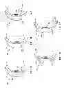Fig. 02 - FACILITATION OF TEAR SAMPLE COLLECTION AND TESTING USING A CONTACT LENS