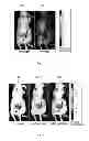 Fig. 02 - Intra-operative molecular imaging