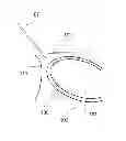 Fig. 01 - Method for puncturing the pericardial membrane by synchronizing needle advancement with cardiac muscle motion