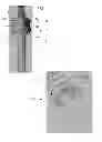 Fig. 02 - Biopsy channel attachment adaptor