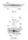 Fig. 09 - Extracorporeal pressure shock wave devices with reversed applicators and methods for using these devices