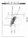 Fig. 72 - Extracorporeal pressure shock wave devices with reversed applicators and methods for using these devices