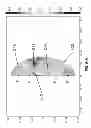 Fig. 77 - Extracorporeal pressure shock wave devices with reversed applicators and methods for using these devices
