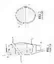 Fig. 02 - Orthopedic device