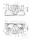 Fig. 06 - Orthopedic device