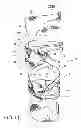 Fig. 07 - Orthopedic device