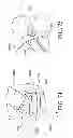 Fig. 35 - Orthopedic device